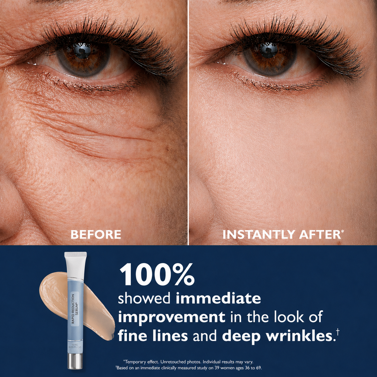 Dermaxa™ - Rapid Reduction Serum