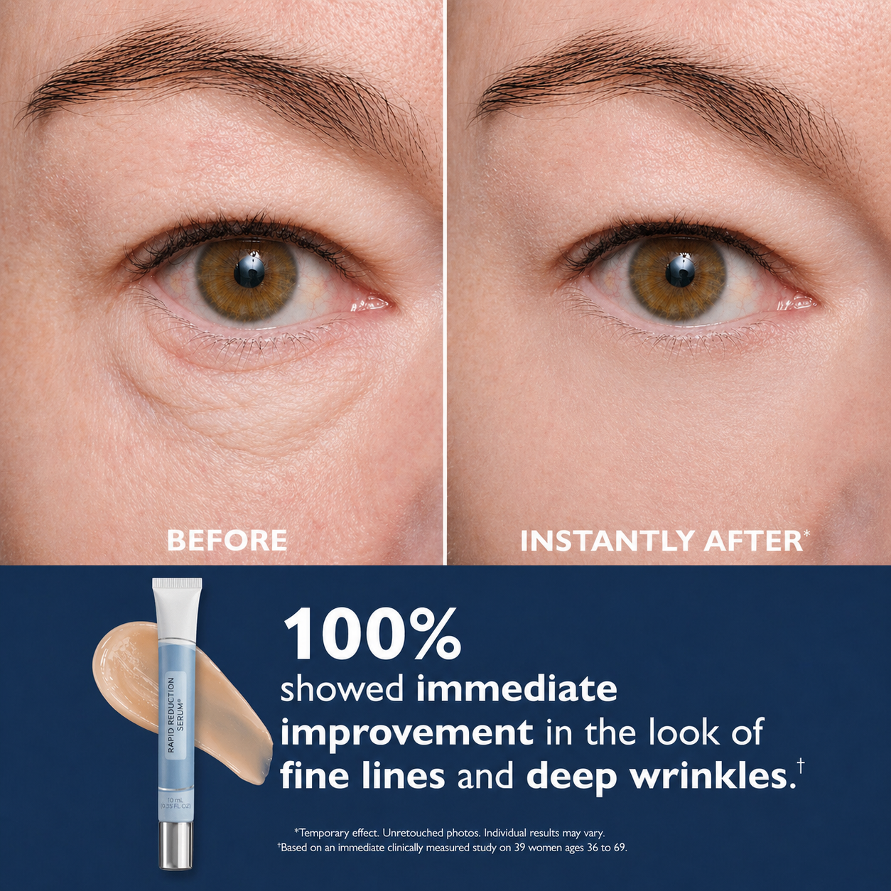Dermaxa™ - Rapid Reduction Serum